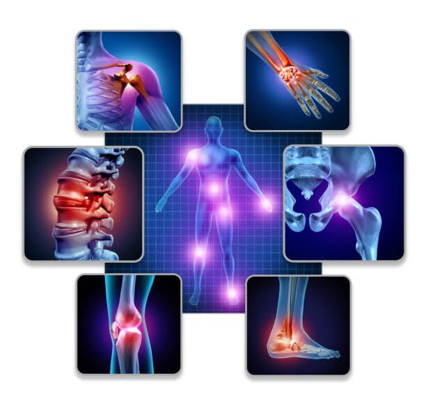 Medical illustration highlighting common joint pain areas across the body